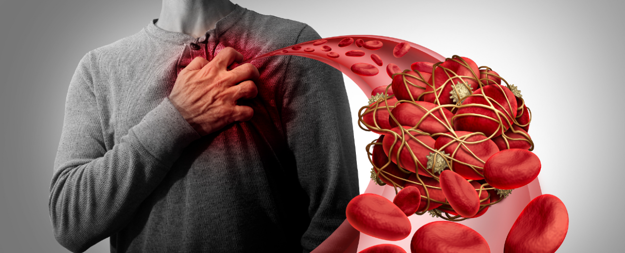 Therapy in Cardiovascular Health